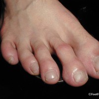 His long toes - Picture 4