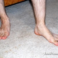 Joseph shows off his feet - Picture 89