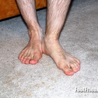 Joseph shows off his feet - Picture 90