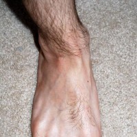 Joseph shows off his feet - Picture 92