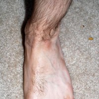 Joseph shows off his feet - Picture 93