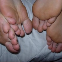 Foot Party - Picture 57