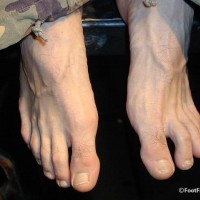 Mystery model feet - Picture 18
