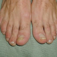 Officer Smith lisk feet - Picture 13