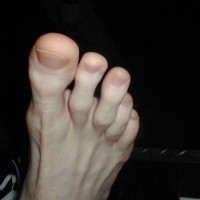 Andy's feet - Picture 15