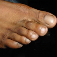 Carlos shows his feet - Picture 11