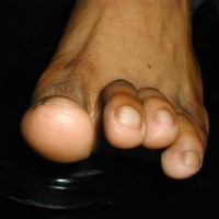 Carlos shows his feet - Picture 12