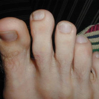 Feet of Asia - Picture 33