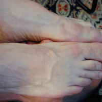 Foot Service - Picture 26